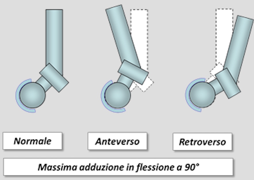 Nella immagine l’analisi della parte adattativa con LED PODO LASER, dalla pianta al bacino